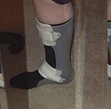 Click image for larger version

Name:	Brace 1.jpg
Views:	149
Size:	111.1 KB
ID:	784389