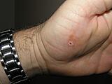Click image for larger version

Name:	18G SH Brad Hole.JPG
Views:	146
Size:	196.1 KB
ID:	791679